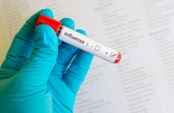 Influenza Phuket Testing and Treatment Services